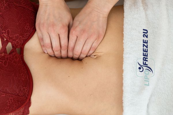 diastasis recti treatment Biggleswade