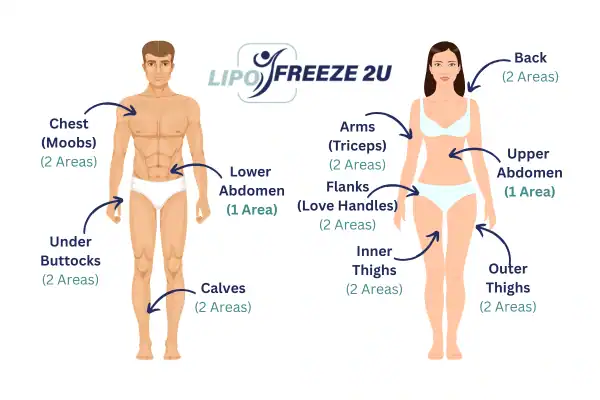 Areas you can have fat freezing treatment Biggleswade