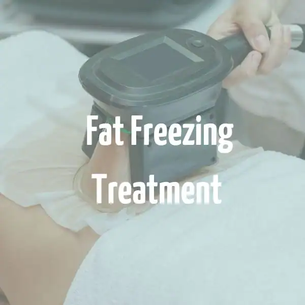 fat freezing treatment Biggleswade