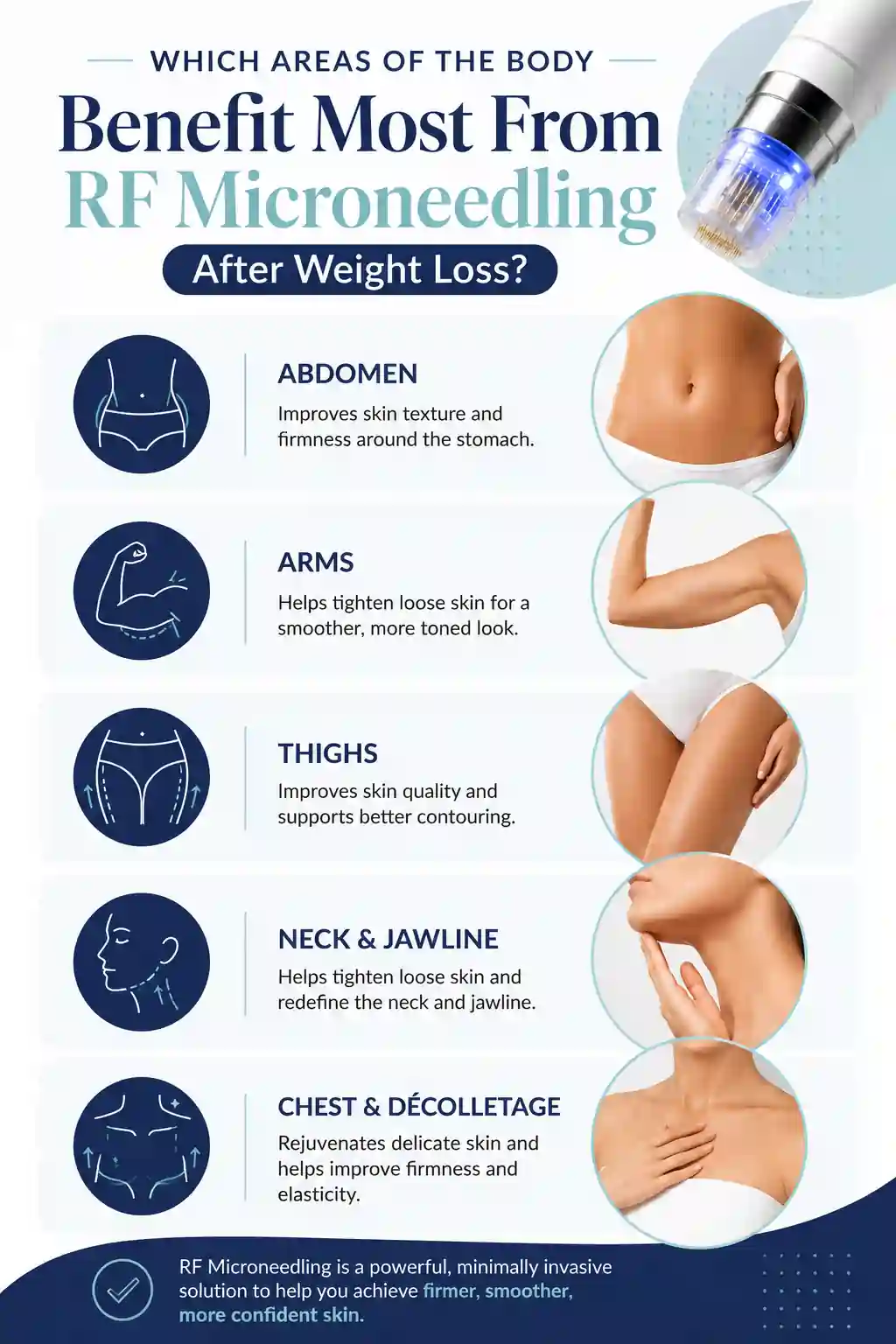 Which Areas of the Body Benefit Most From RF Microneedling After Weight Loss Biggleswade