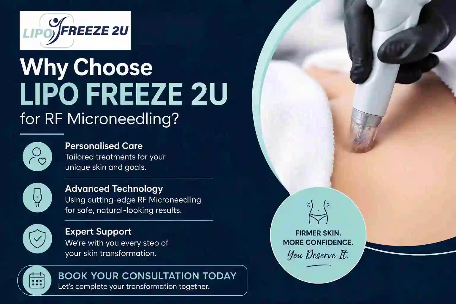 Why Choose LIPO FREEZE 2U for RF Microneedling Biggleswade?